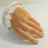 a plaster hand 